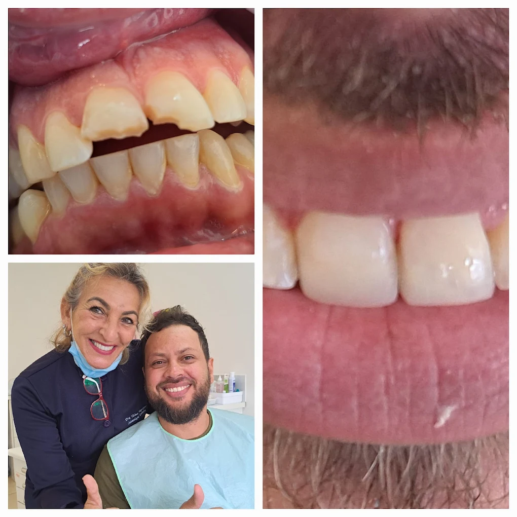 Transformação do sorriso com tratamento estético